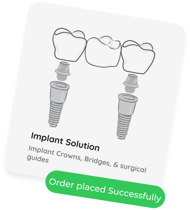 Teeth Implant Solutions